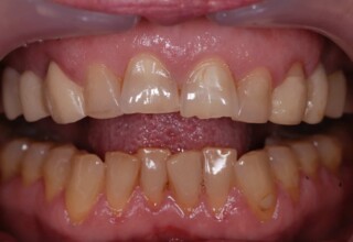 Unesthetic patient’s smile.