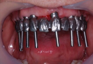 Metal frame try in.