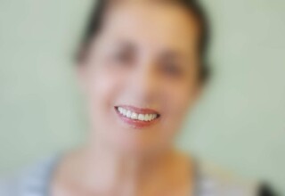 Χαμόγελο με την άνω τελική προσθετική αποκατάσταση.