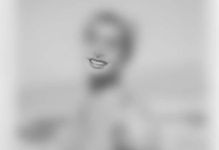Old photos used to assess the natural shape of the teeth and their relationship with patient’s smile and face.