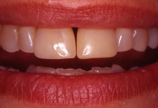 Initial patient’s smile.